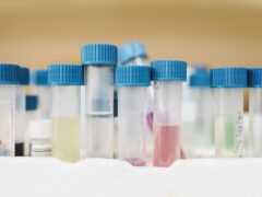 Close-up of test tubes in a laboratory with colored liquids