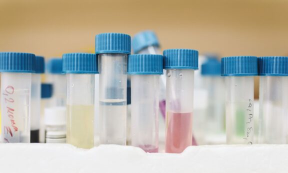 Close-up of test tubes in a laboratory with colored liquids